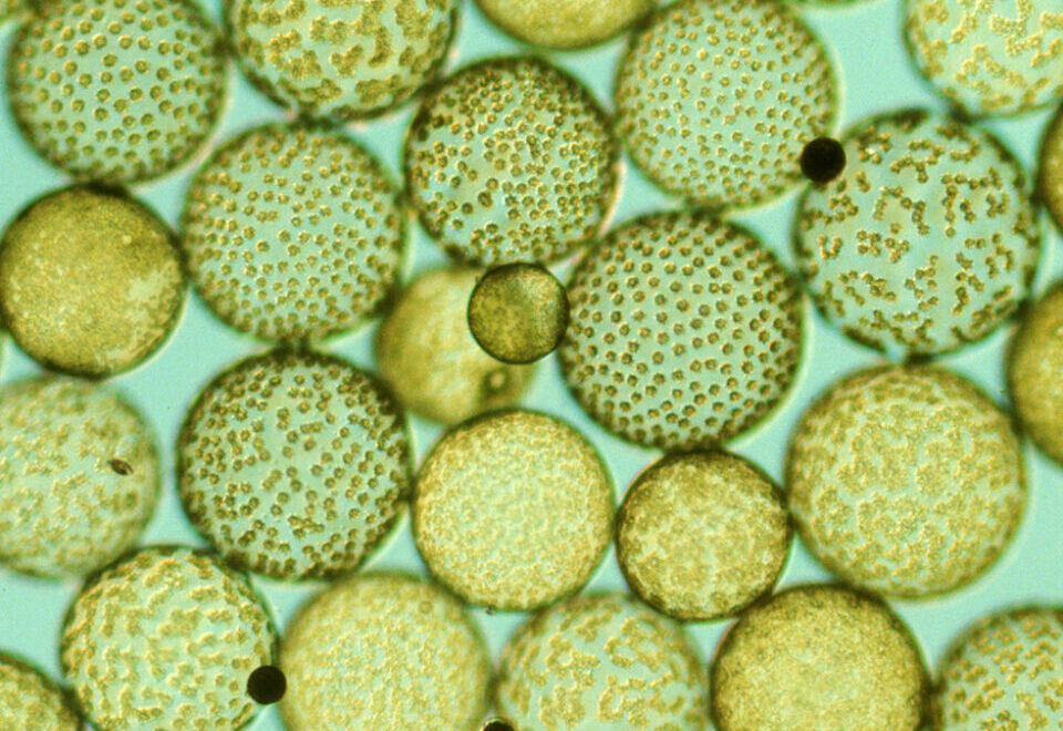 Microscope closeup of Halosphaera parkeae algae